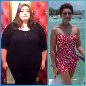 weight loss surgery