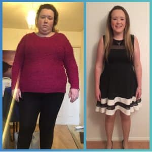 weight loss surgery